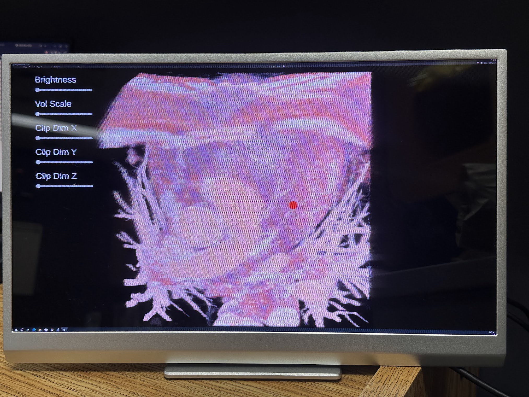 Medical DICOM Viewer project preview 1
