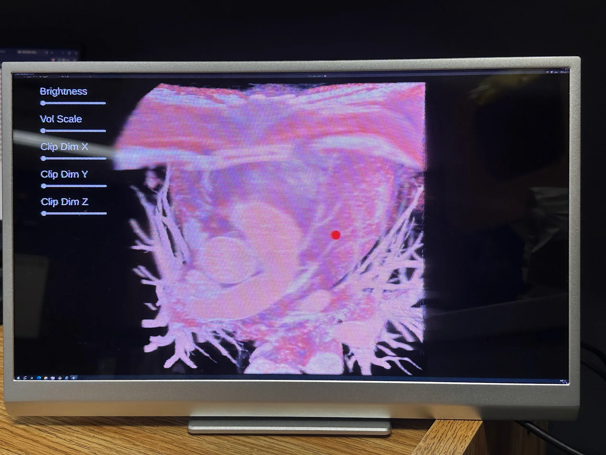 Medical DICOM Viewer project preview